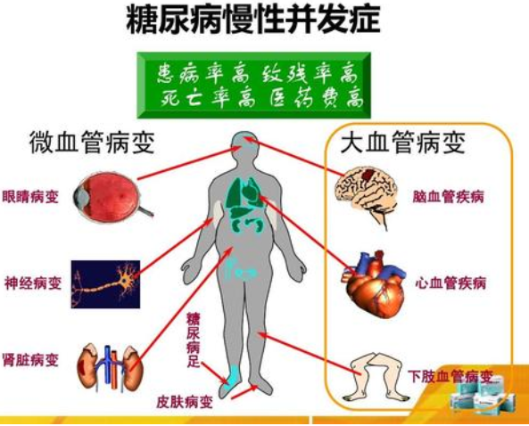 糖尿病有什么危害.png
