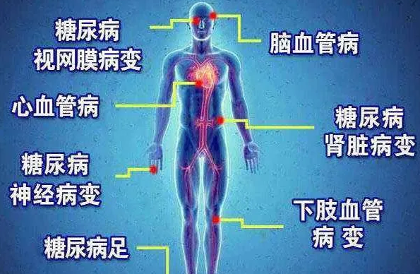 糖尿病病足怎么治疗.png