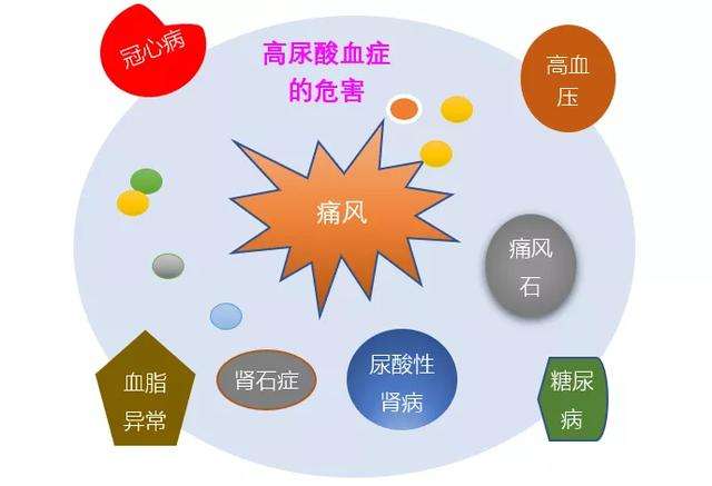 尿酸高诱发痛风发作吗？痛风的症状有哪些？