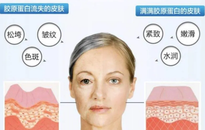 哪些人群适合服用胶原蛋白肽？胶原蛋白适合什么人服用？