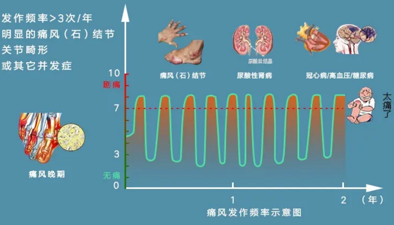 痛风怎么治疗效果好.png