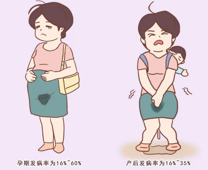 中老年人漏尿是怎么回事，干细胞与压力性尿失禁