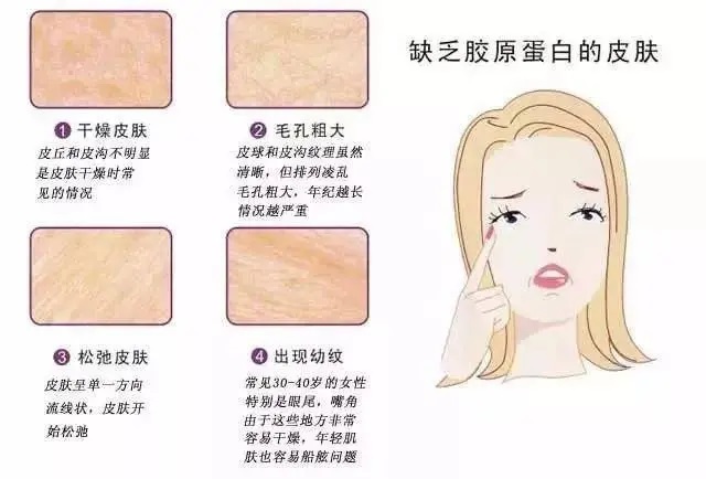 哪个牌子的胶原蛋白肽好,女人吃胶原蛋白肽皮肤会好吗？