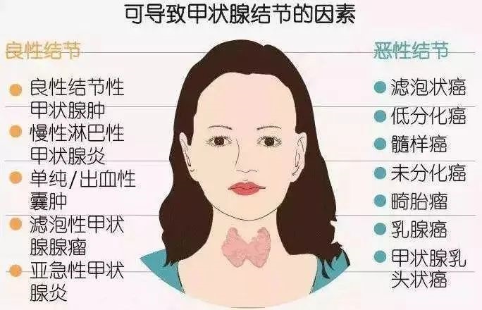 甲状腺结节会有疼痛感吗,如何预防甲状腺结节?