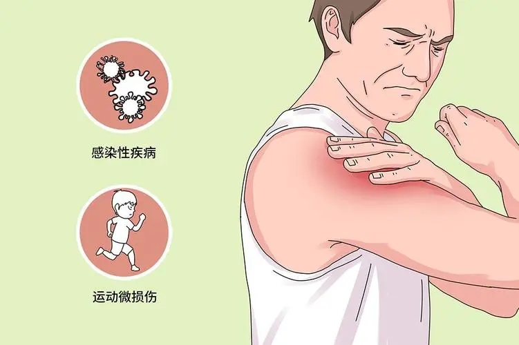 肌肉疼痛的症状,肌肉痛可以做哪些理疗?