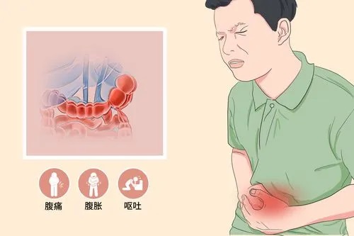 肠梗阻有什么症状,肠梗阻什么中成药？