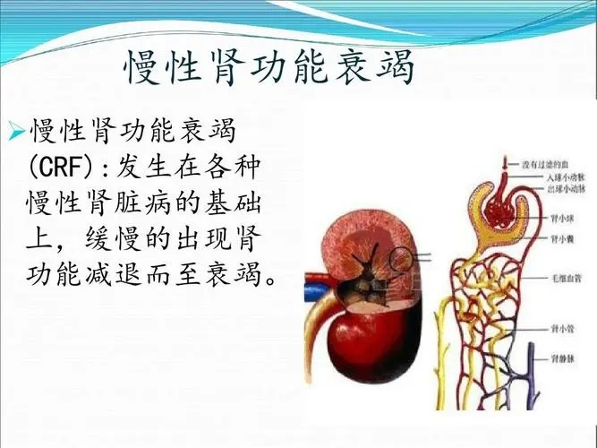慢性肾功能衰竭原因分析,肾功能衰竭能用中药能调理吗?
