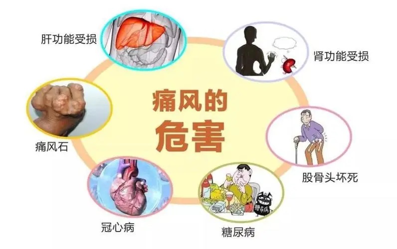 痛风关节疼痛的主要原因,如何预防痛风？