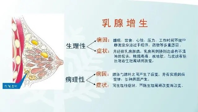 乳腺增生的症状,乳腺增生怎么办？