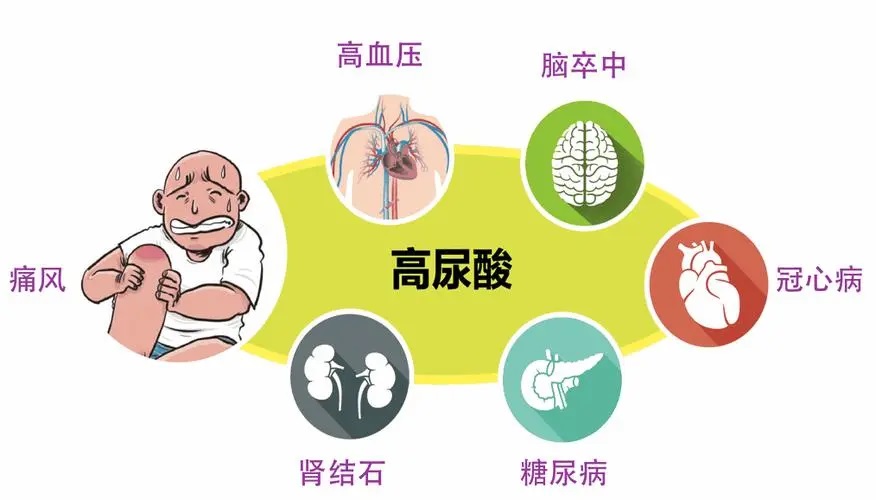 高尿酸有什么症状怎样预防?