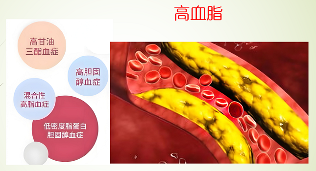 纳豆地龙蛋白肽调节血脂代谢的原理,纳豆地龙蛋白肽能降血脂吗?