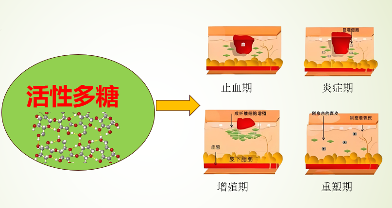 活性多糖对糖尿病足有帮助吗,活性多糖对伤口愈合的效果怎么样?