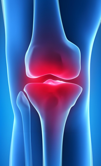 牛骨髓肽对关节疼痛有效果吗,牛骨髓肽对关节疼痛的好处。